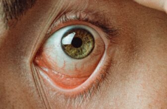 How Not To Strive Contact Lenses