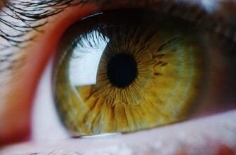 Man Will get Eye Examination, Learns He is Had a S...