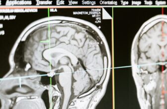 Stanford’s Profitable Mind Implant Restores Oper...